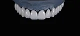 Seamless gradience dental zirconia disc